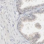 MAGEA8 Antibody in Immunohistochemistry (IHC)