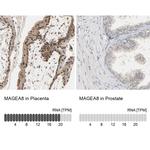 MAGEA8 Antibody