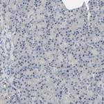 MT3 Antibody in Immunohistochemistry (IHC)