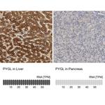 PYGL Antibody in Immunohistochemistry (IHC)