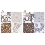 PYGL Antibody in Immunohistochemistry (IHC)