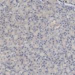 PYGL Antibody in Immunohistochemistry (IHC)