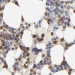 PYGL Antibody in Immunohistochemistry (IHC)