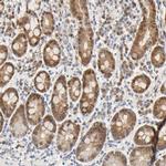 ACSS2 Antibody in Immunohistochemistry (IHC)