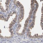 RBM23 Antibody in Immunohistochemistry (IHC)