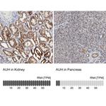 AUH Antibody in Immunohistochemistry (IHC)