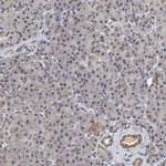 AUH Antibody in Immunohistochemistry (IHC)