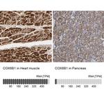 COX6B1 Antibody in Immunohistochemistry (IHC)