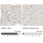 NCOA6 Antibody