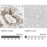 DAZAP1 Antibody in Immunohistochemistry (IHC)