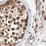 AFG3L2 Antibody in Immunohistochemistry (IHC)