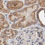 AFG3L2 Antibody in Immunohistochemistry (IHC)