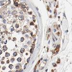 AFG3L2 Antibody in Immunohistochemistry (IHC)