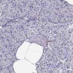 MAGEC1 Antibody in Immunohistochemistry (IHC)