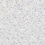 DAZAP1 Antibody in Immunohistochemistry (IHC)