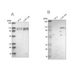 STRN3 Antibody in Western Blot (WB)