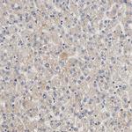 ARHGEF7 Antibody in Immunohistochemistry (IHC)