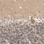 ARHGEF7 Antibody in Immunohistochemistry (IHC)