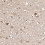 ARHGEF7 Antibody in Immunohistochemistry (IHC)