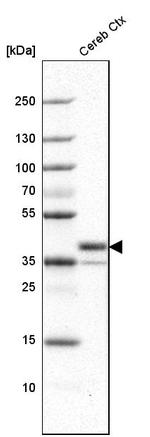 LAMP5 Antibody in Western Blot (WB)