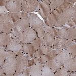 EYA4 Antibody in Immunohistochemistry (IHC)