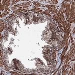 EYA4 Antibody in Immunohistochemistry (IHC)