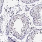 BARHL1 Antibody in Immunohistochemistry (IHC)