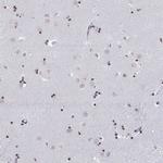 BARHL1 Antibody in Immunohistochemistry (IHC)