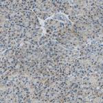 NNT Antibody in Immunohistochemistry (IHC)