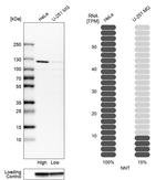 NNT Antibody in Western Blot (WB)