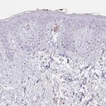 HRC Antibody in Immunohistochemistry (IHC)