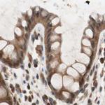 GALT Antibody in Immunohistochemistry (IHC)