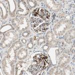 MFI2 Antibody in Immunohistochemistry (IHC)