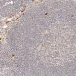 PTPN22 Antibody in Immunohistochemistry (IHC)