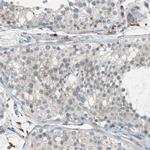 PTGDS Antibody in Immunohistochemistry (IHC)