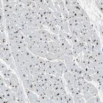 PTGDS Antibody in Immunohistochemistry (IHC)