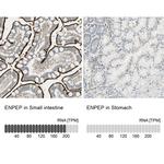 CD249 Antibody in Immunohistochemistry (IHC)