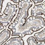 CD249 Antibody in Immunohistochemistry (IHC)