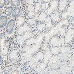 CD249 Antibody in Immunohistochemistry (IHC)