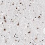 ARID1A Antibody in Immunohistochemistry (IHC)