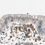 SKAP2 Antibody in Immunohistochemistry (IHC)