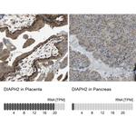 DIAPH2 Antibody in Immunohistochemistry (IHC)