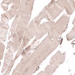 TRIM21 Antibody in Immunohistochemistry (IHC)