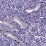 FOXJ1 Antibody in Immunohistochemistry (IHC)