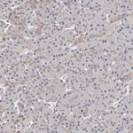 TRIP13 Antibody in Immunohistochemistry (IHC)