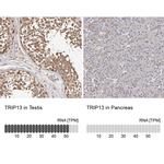 TRIP13 Antibody