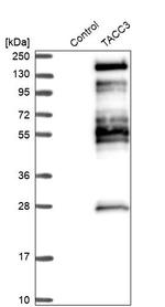 TACC3 Antibody in Western Blot (WB)