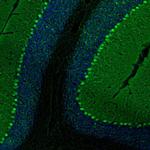 PCP4 Antibody in Immunohistochemistry (IHC)