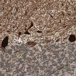 PCP4 Antibody in Immunohistochemistry (IHC)