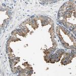 RASD2 Antibody in Immunohistochemistry (IHC)